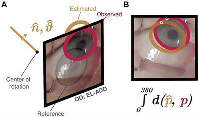 A protocol to quantify cross-sectional and longitudinal differences in duction patterns